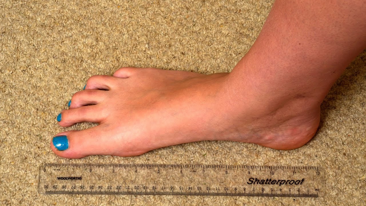 Gingerspyce feet