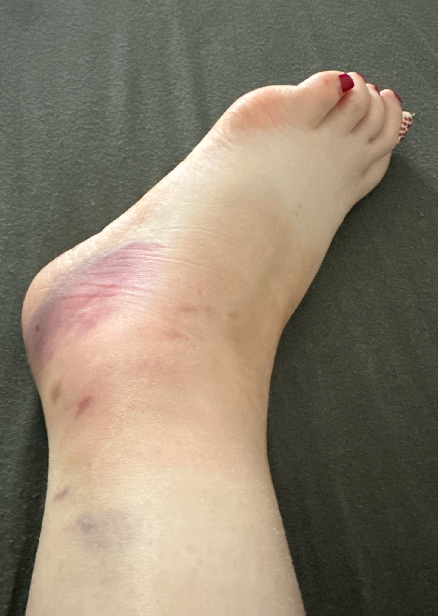 Alice Davidson's feet