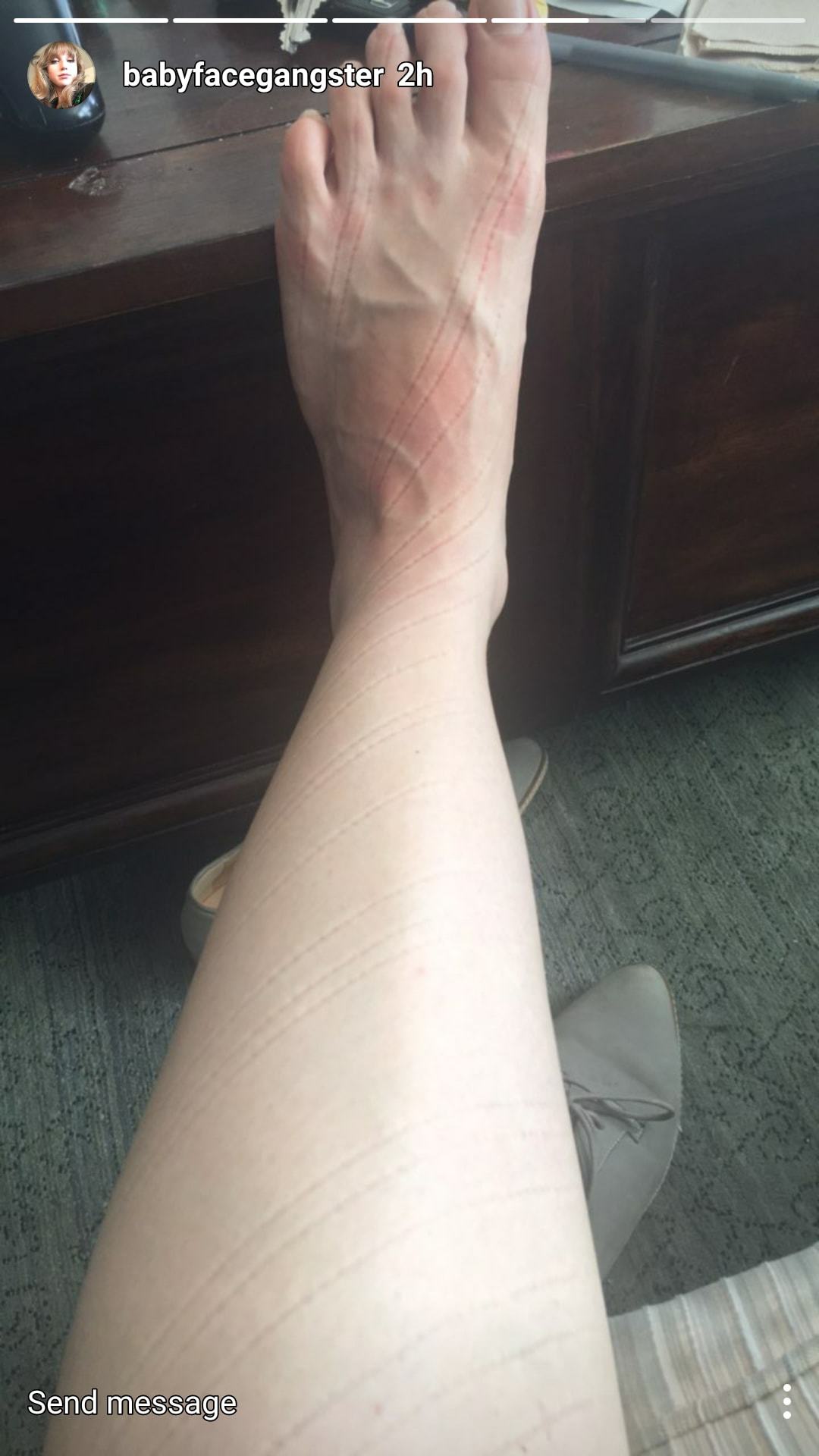 Amy Bruckner's Feet - I piedi di Amy Bruckner - Celebrities Feet 2022