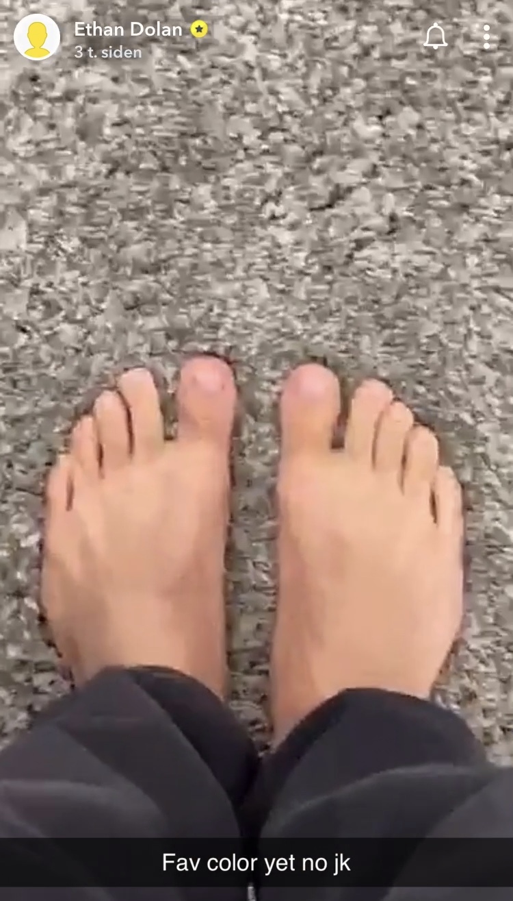 Dolan twins feet