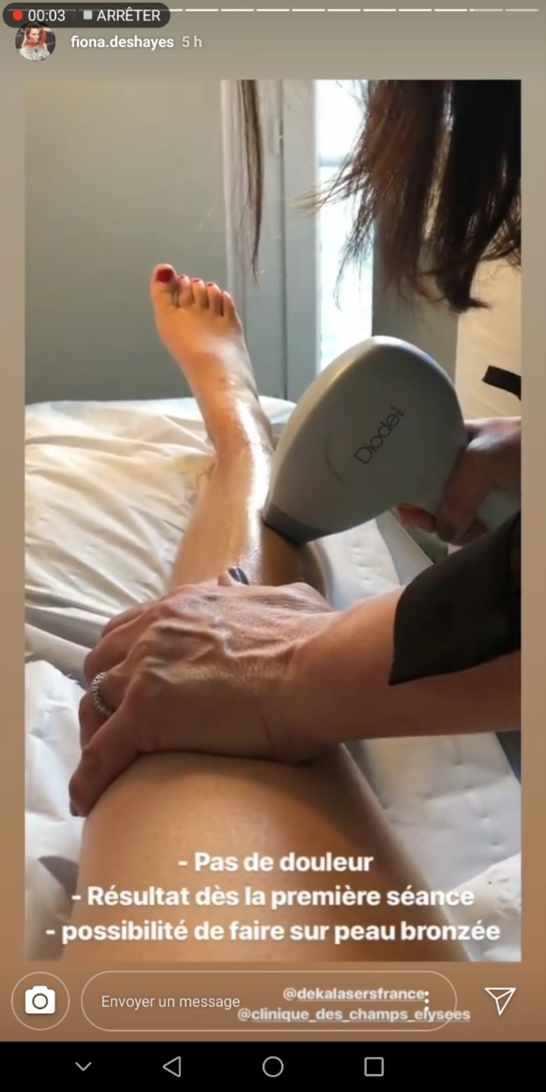 Feet of Fiona Deshayes