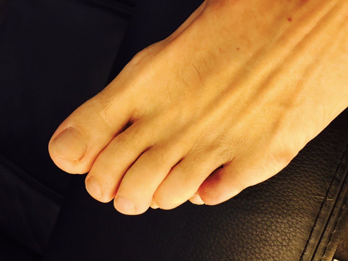 Gary Barlows Feet