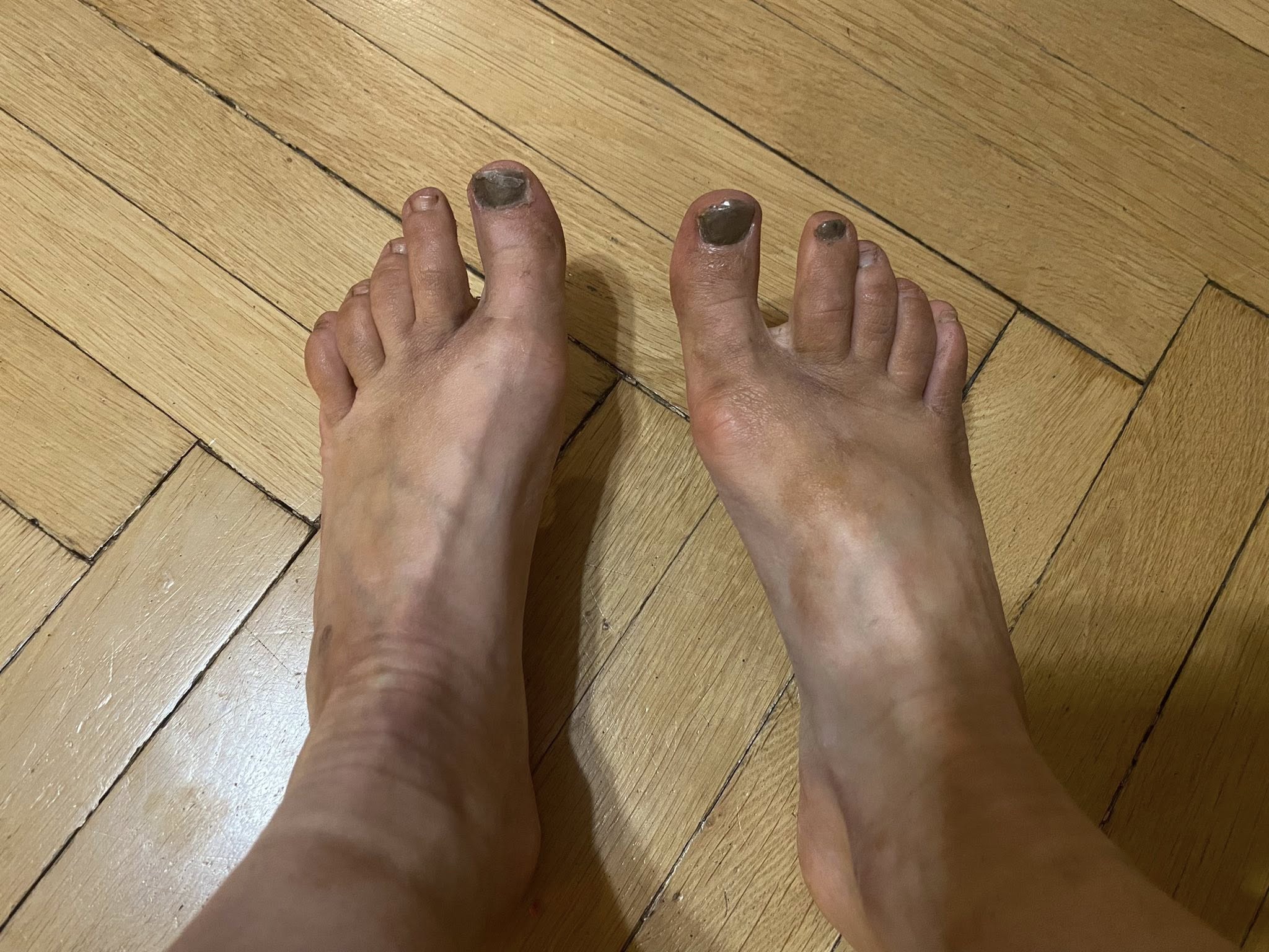 Feet of Jadwiga Wianecka