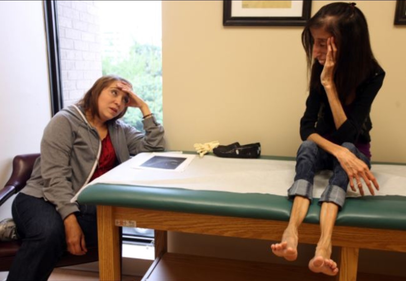 Lizzie Velasquez S Feet I Piedi Di Lizzie Velasquez Celebrities