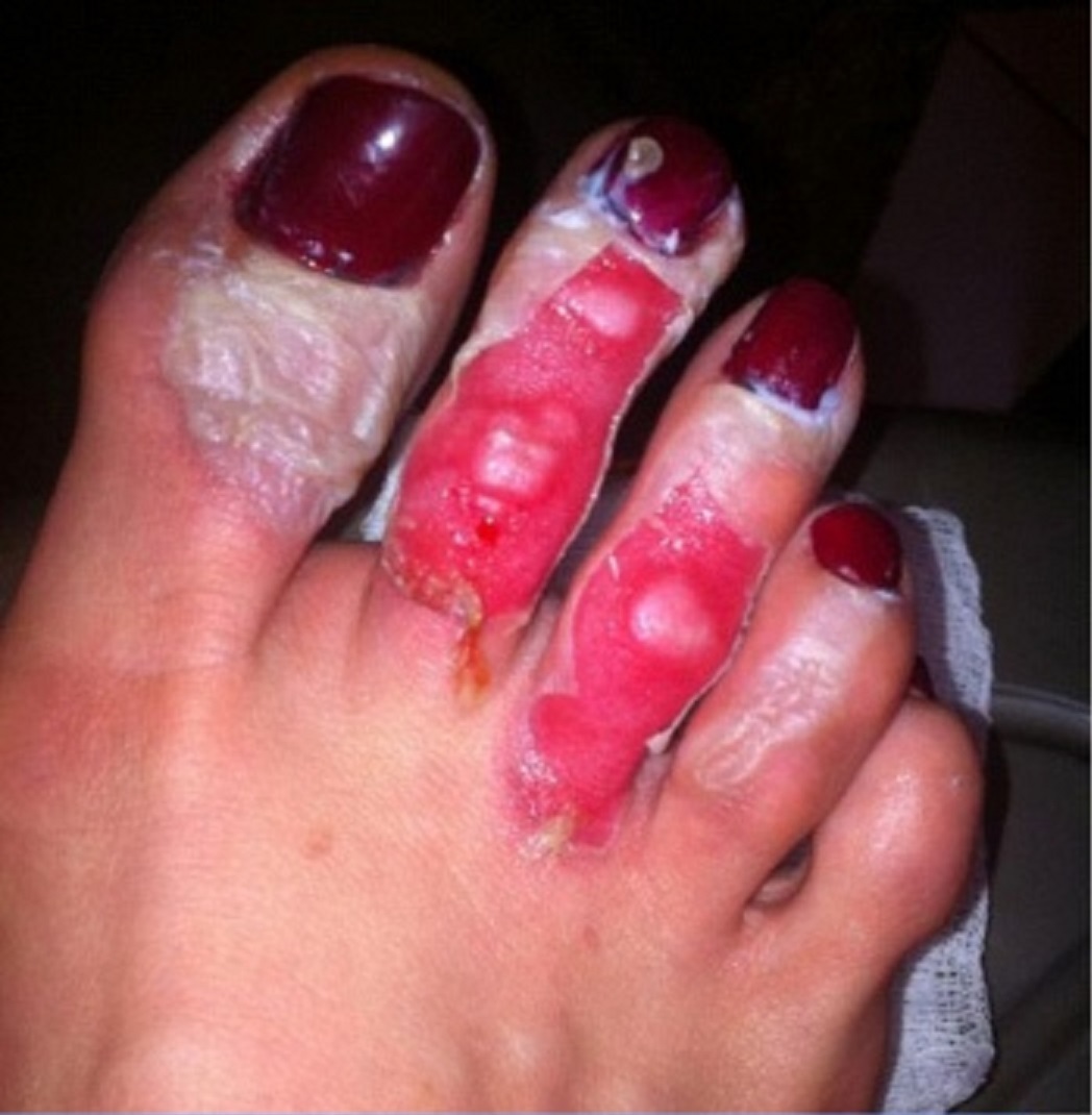 Feet of Malillany Marín